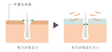 「毛穴ケア」におすすめの理由